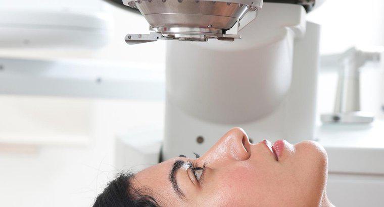 O que são tratamentos a laser para glaucoma?