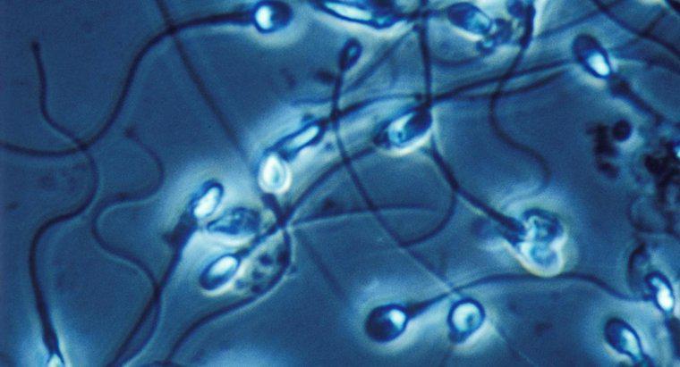 Quais são os tratamentos para a morfologia anormal dos espermatozoides?