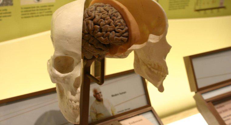 O que os ventrículos cerebrais aumentados indicam?