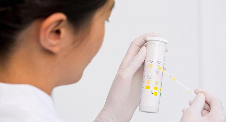 O que é um teste de microalbumina de urina para diabetes?