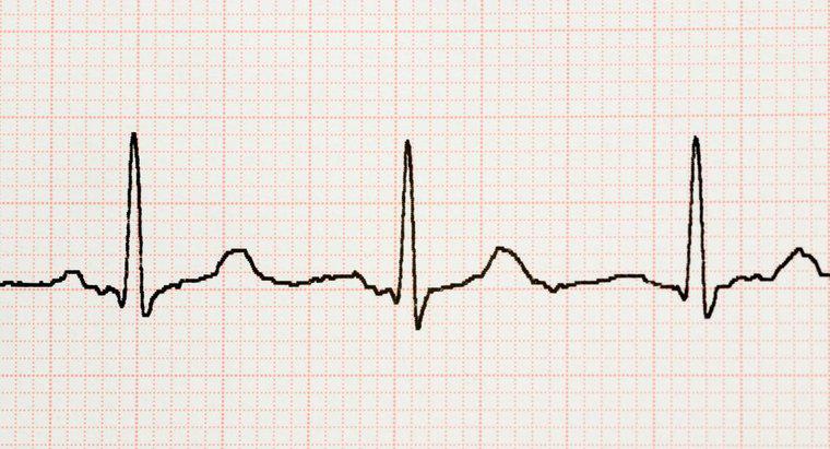 O que é um tremor cardíaco?