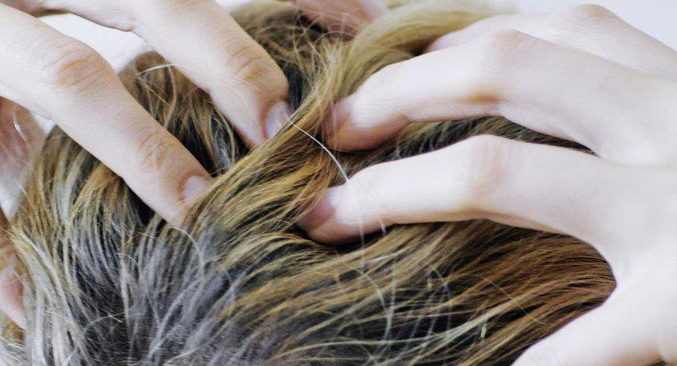 O que causa coceira no couro cabeludo e perda de cabelo?