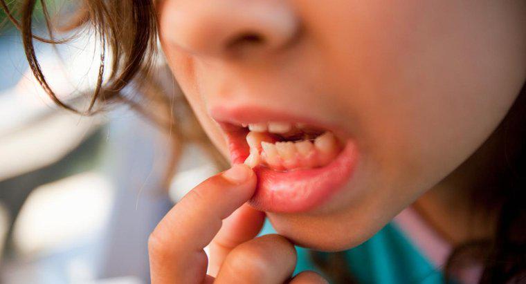 O que causa dentes soltos em adultos?
