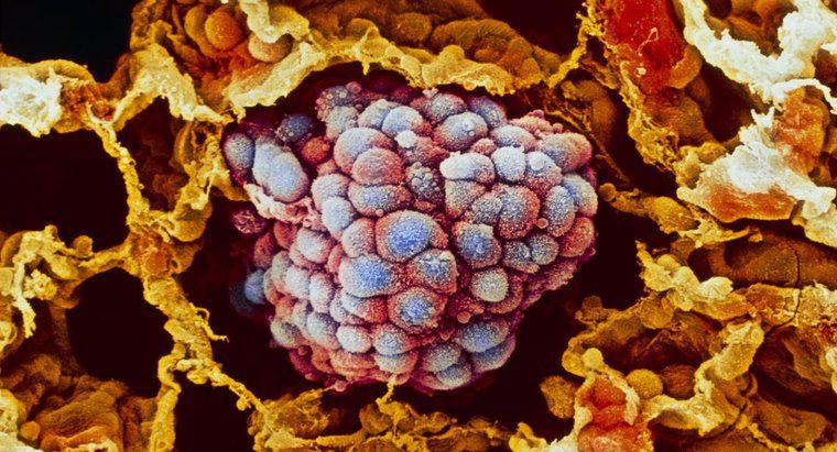 O que são células pré-cancerosas?