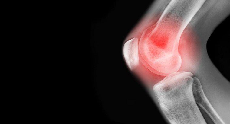 Quais são algumas das causas da dor no joelho esquerdo?
