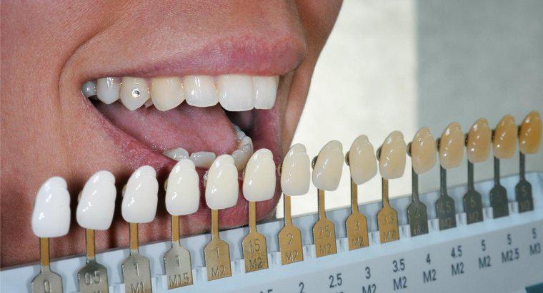 Os dentes falsos podem ser clareados?