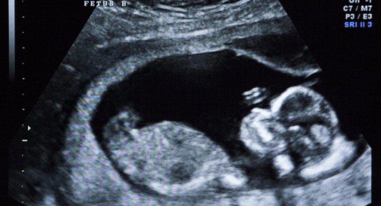 Com que precisão um ultrassom pode determinar a data de concepção?