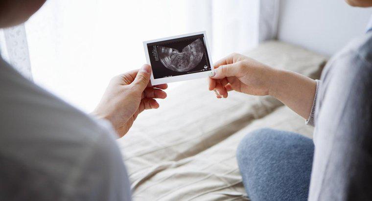 Como você pode determinar se o feto é masculino ou feminino?