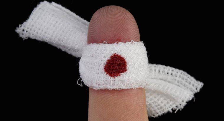 Por que meu dedo não para de sangrar?