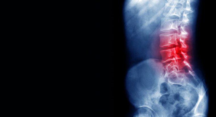 Quais são as causas da dor nas costas?