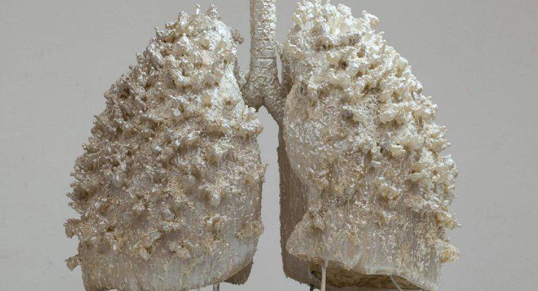 Uma pessoa pode viver com um pulmão?