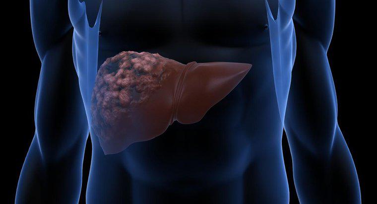 Quais são as causas da doença hepática?