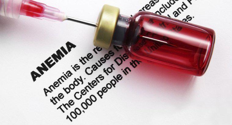 Como você pode testar os níveis de hemograma para anemia?