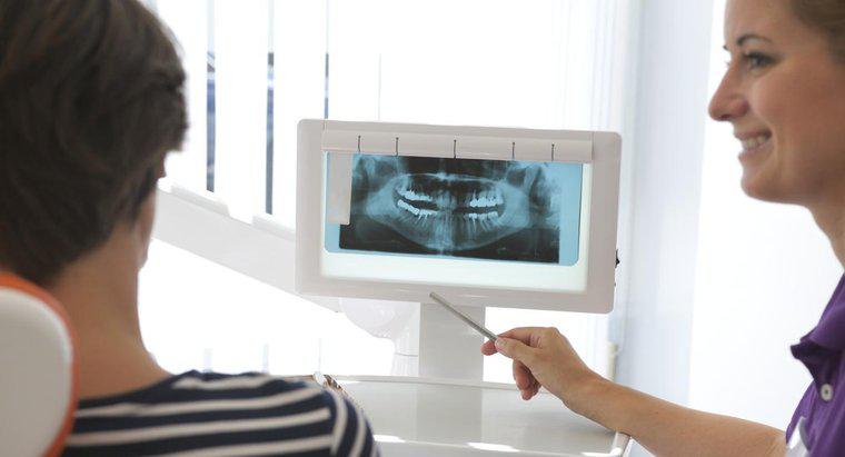 Quanto devo esperar pagar pelos implantes dentários?